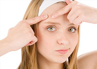 خطوات تخلصك من الرؤوس السوداء في المنزل