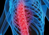 مشاكل العمود الفقري وطرق العلاج