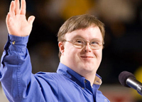 العلاقة بين "متلازمة داون" وتأخر اللغة واضطرابات النطق