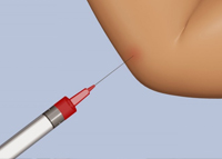 التغذية السليمة بعد العلاج بالكورتيزون
