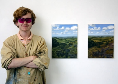 أمراض تصيب الرجال أكثر من النساء!