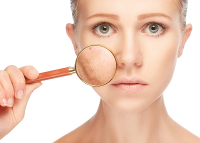 3 وصفات طبيعية للتخلص من البقع الداكنة في البشرة