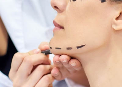 تقنية الخيوط لشدّ الوجه من دون جراحة 