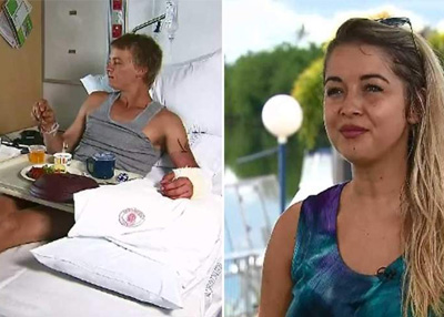 مراهق استرالي يعضه تمساح في رهان مع صديقة حاول إثارة إعجابها